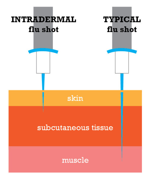 cassidy-alexander-needle-comparison-01